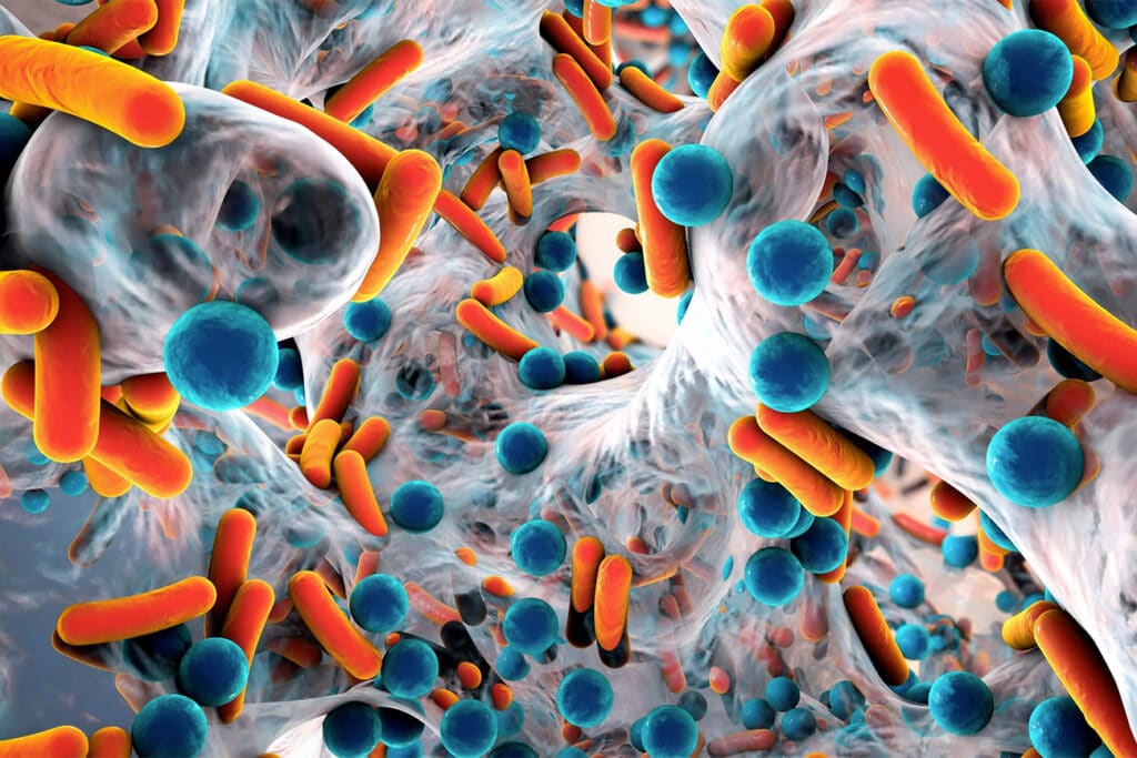 Efficiënt verwijderen en voorkomen van biofilms 1