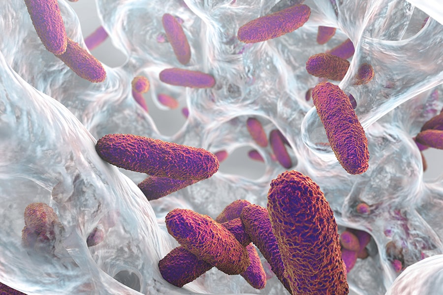 Alles wat je moet weten over biofilmcontrole 1